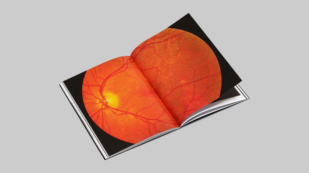 Dark Side of the Moon by Marianne Bernstein